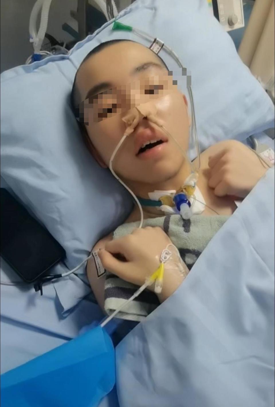 晚自習嬉鬧!14歲國三生「被女同學打中左胸」休克癱瘓 家屬崩潰「拿不到醫藥賠償」原因曝光了...