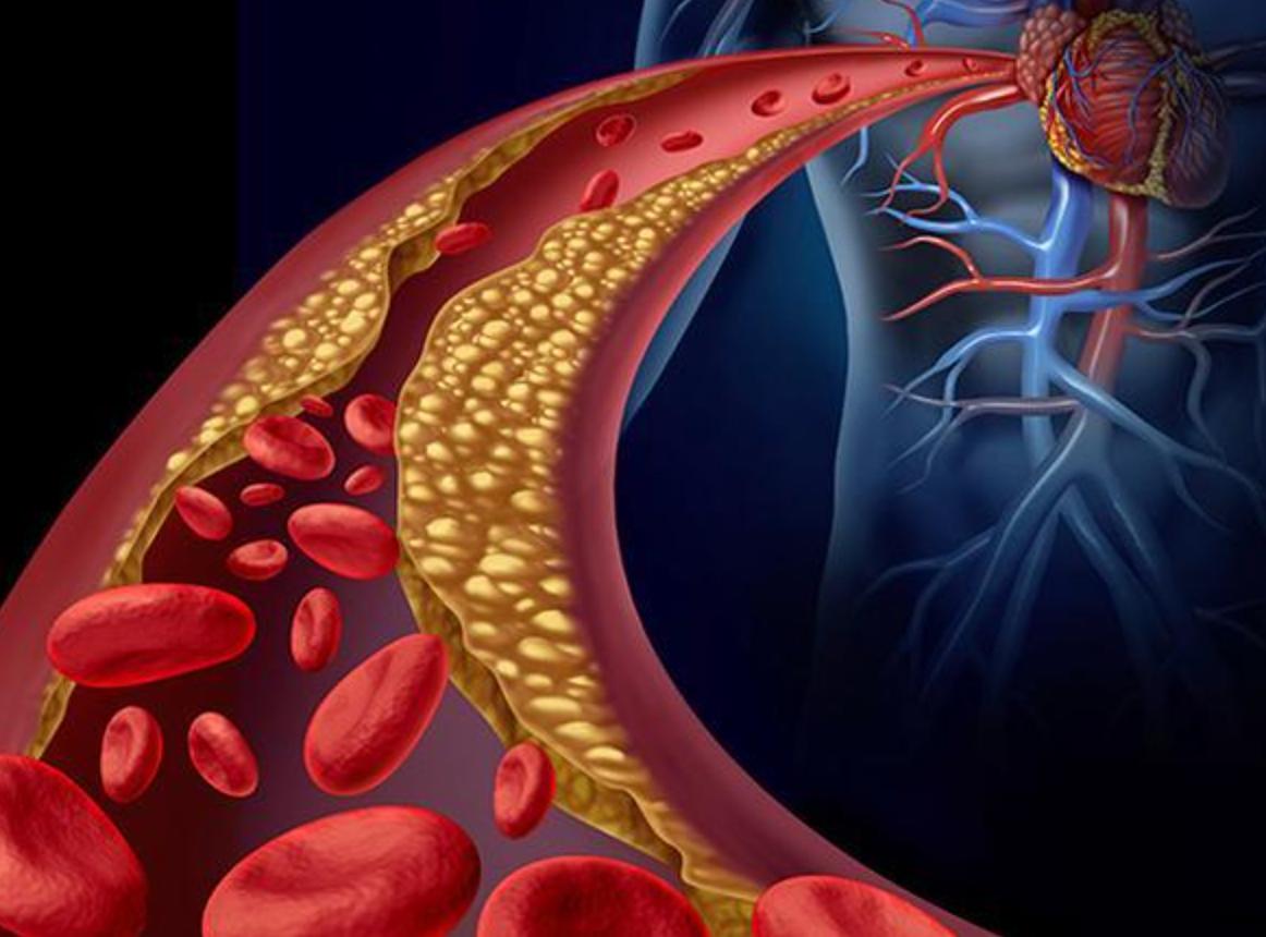 秋冬「膽固醇剋星」找到了!潤肺止咳「還護心血管」 很多人愛吃「一類型要謹慎」以免中毒
