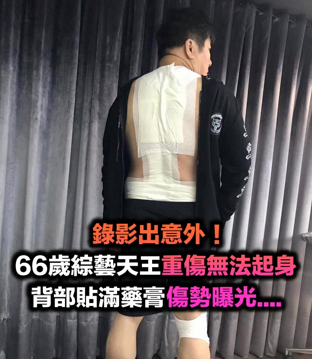 錄影出意外!66歲胡瓜「重摔無法起身」緊急送醫 「背部貼滿藥膏」堅持繼續工作:不能辜負粉絲