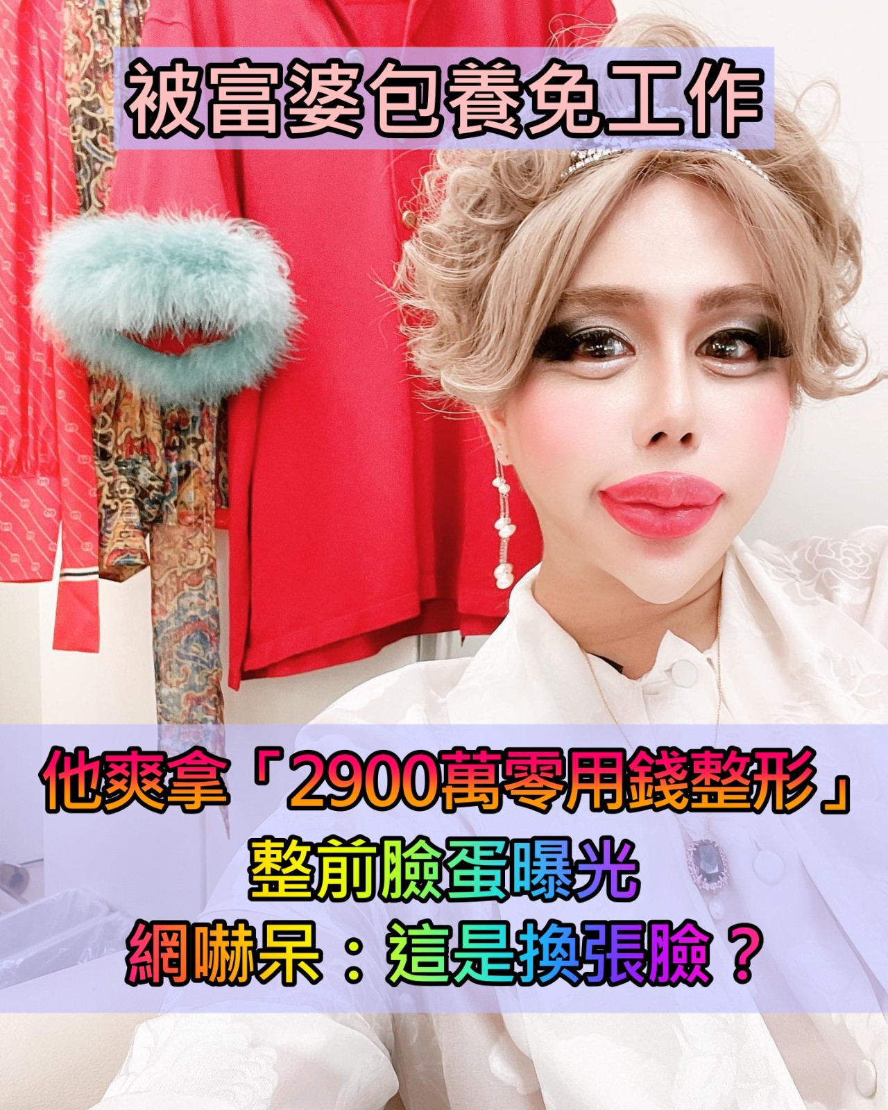 被富婆包養!他不工作「狂燒2900萬整形」還能拿零用錢 每天陪金主吃飯「整前臉蛋曝光」網嚇呆