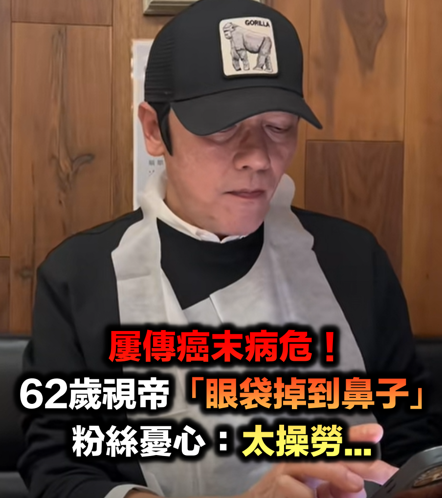 屢傳癌末病危！62歲大咖視帝「眼袋掉到鼻子」照片曝光　粉絲全擔憂：太操勞