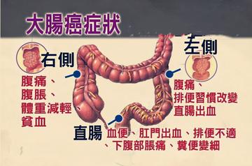 大腸癌年輕化！「台灣7.8年級生」罹腸癌風險最高　醫證實「2關鍵害的」快戒掉：老年人反而沒有