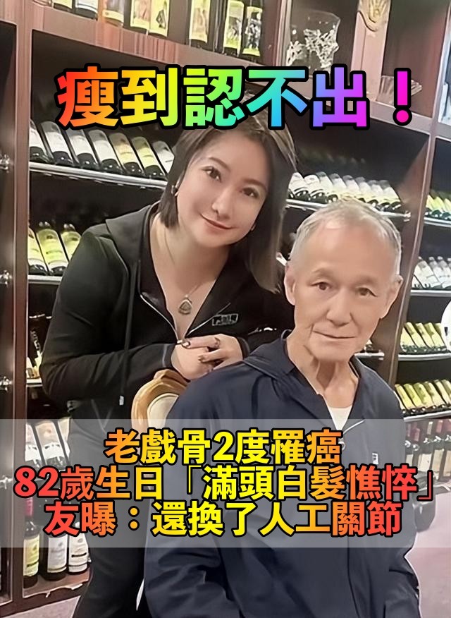 曾2度罹癌！82歲老戲骨提前慶生「竟暴瘦成皮包骨」　才過半年「黑髮全花白」健康狀態堪憂...