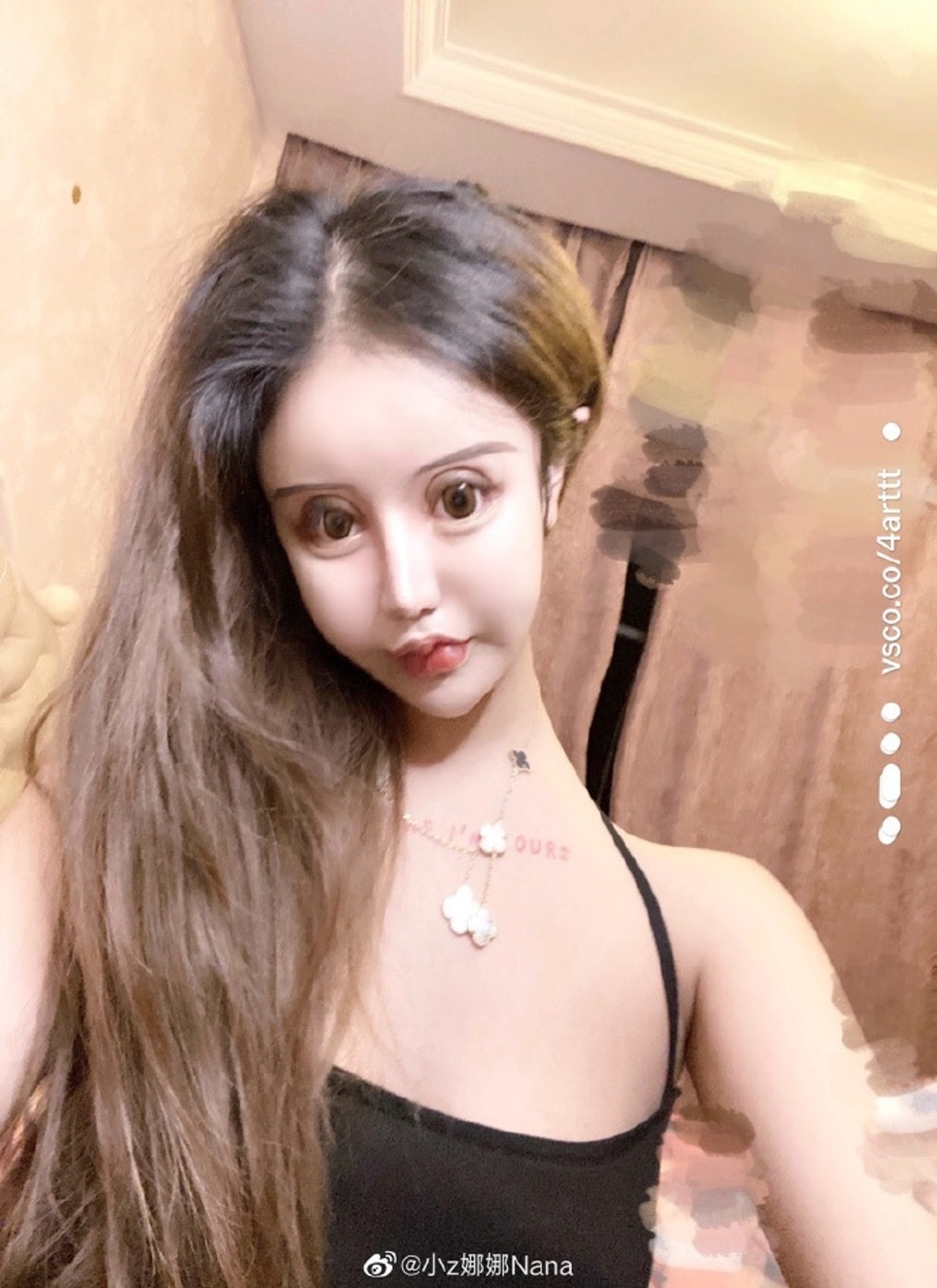 整容上癮!20歲蛇精女「花父母1700萬」動刀上百次 整前「清純模樣曝光」她喊:開心就好