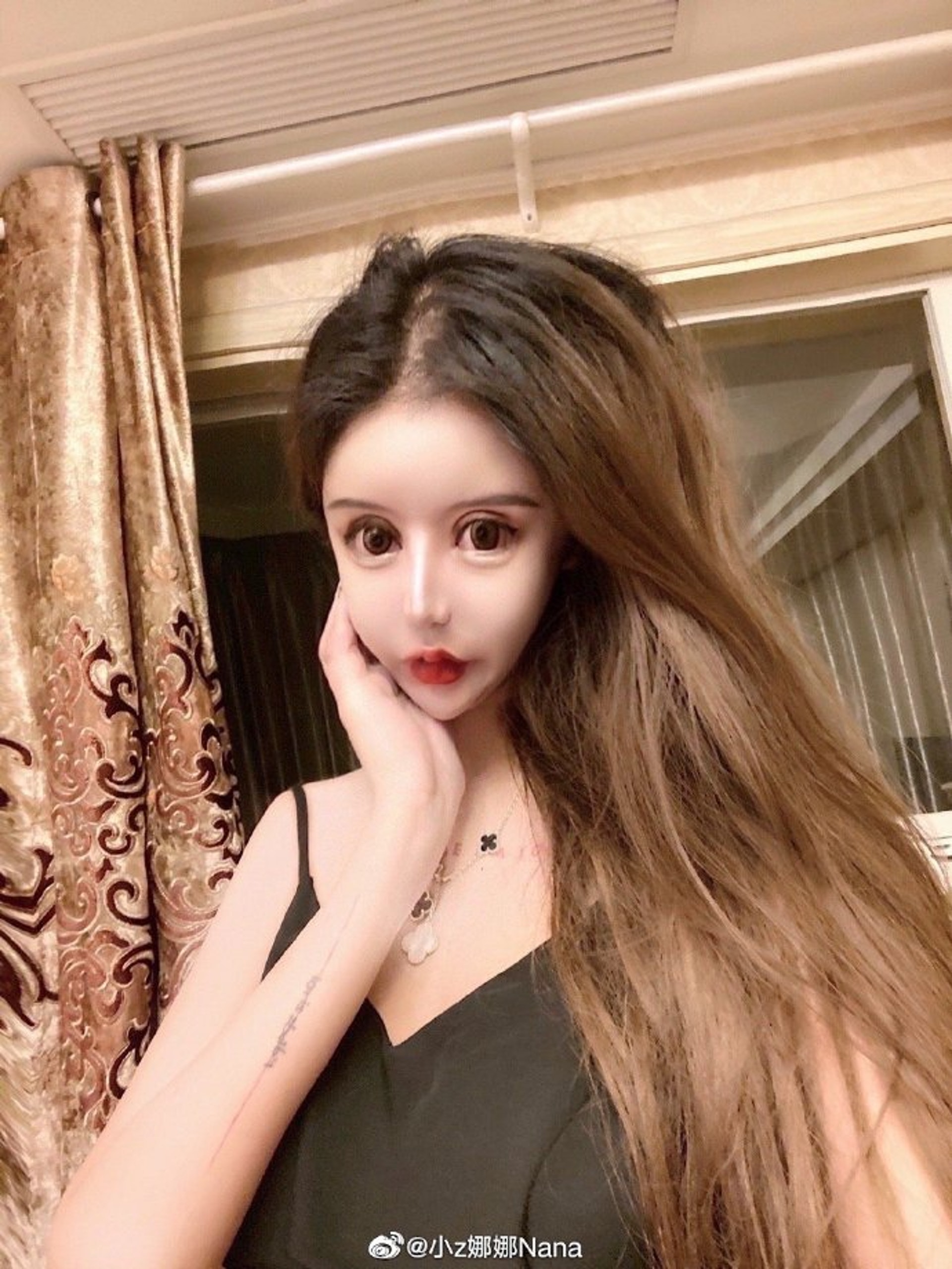 整容上癮!20歲蛇精女「花父母1700萬」動刀上百次 整前「清純模樣曝光」她喊:開心就好