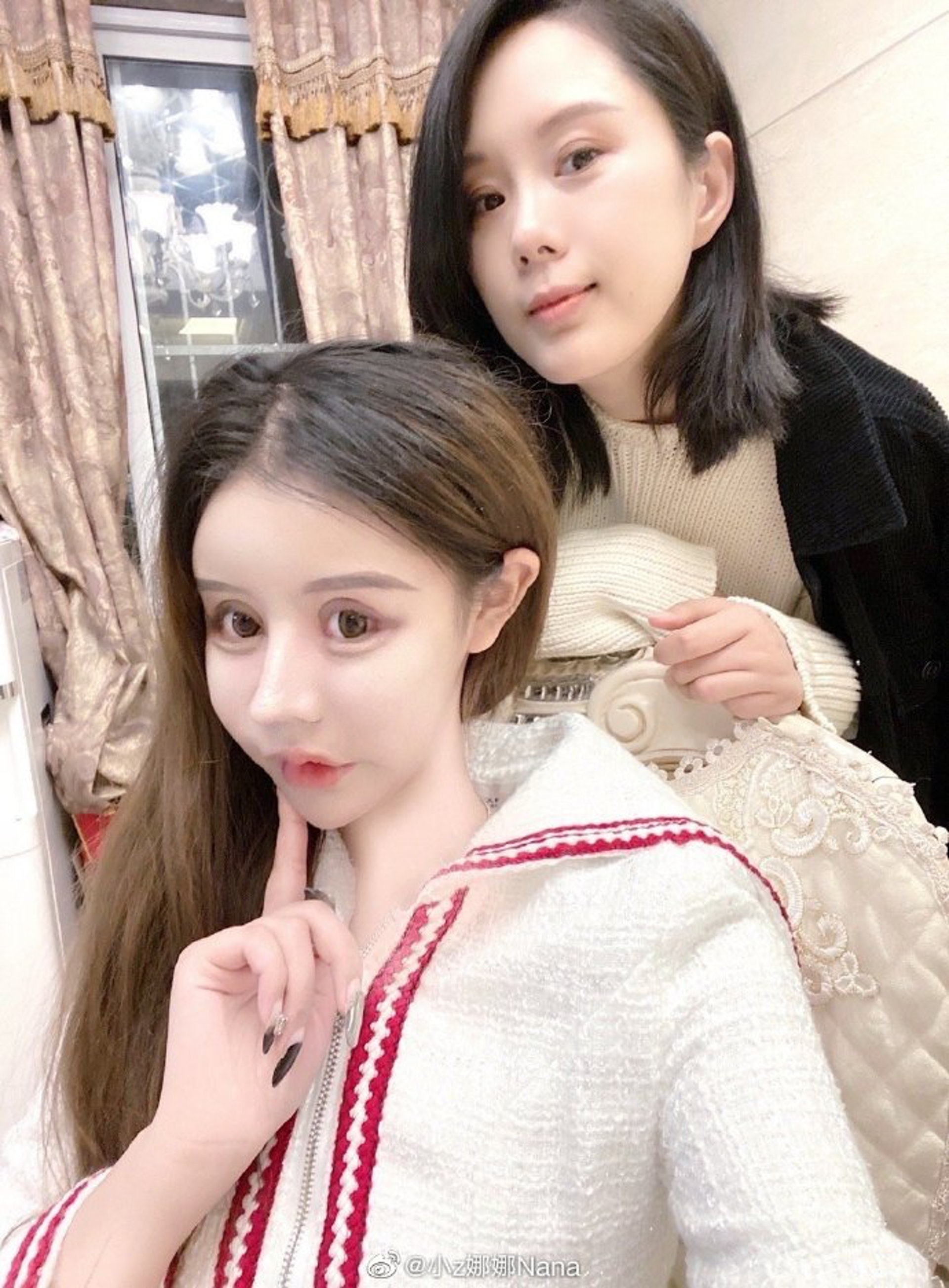 整容上癮!20歲蛇精女「花父母1700萬」動刀上百次 整前「清純模樣曝光」她喊:開心就好