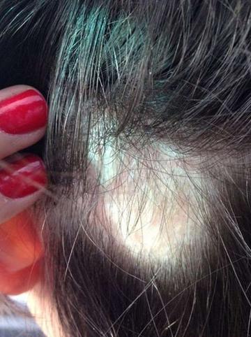 掉髮元凶找到了！研究發現「常喝2大飲品」落髮機率大增　多補充「一關鍵營養」保住年輕秀髮