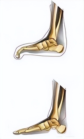 馬上停止穿這種襪子!不知不覺「在傷害下半身」:一堆人秋冬超愛穿