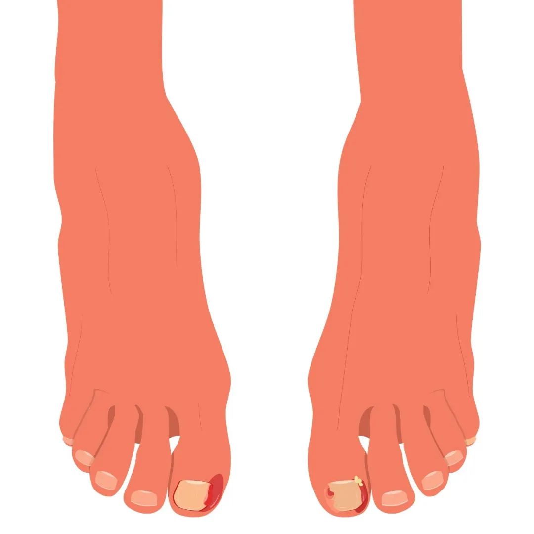 馬上停止穿這種襪子!不知不覺「在傷害下半身」:一堆人秋冬超愛穿