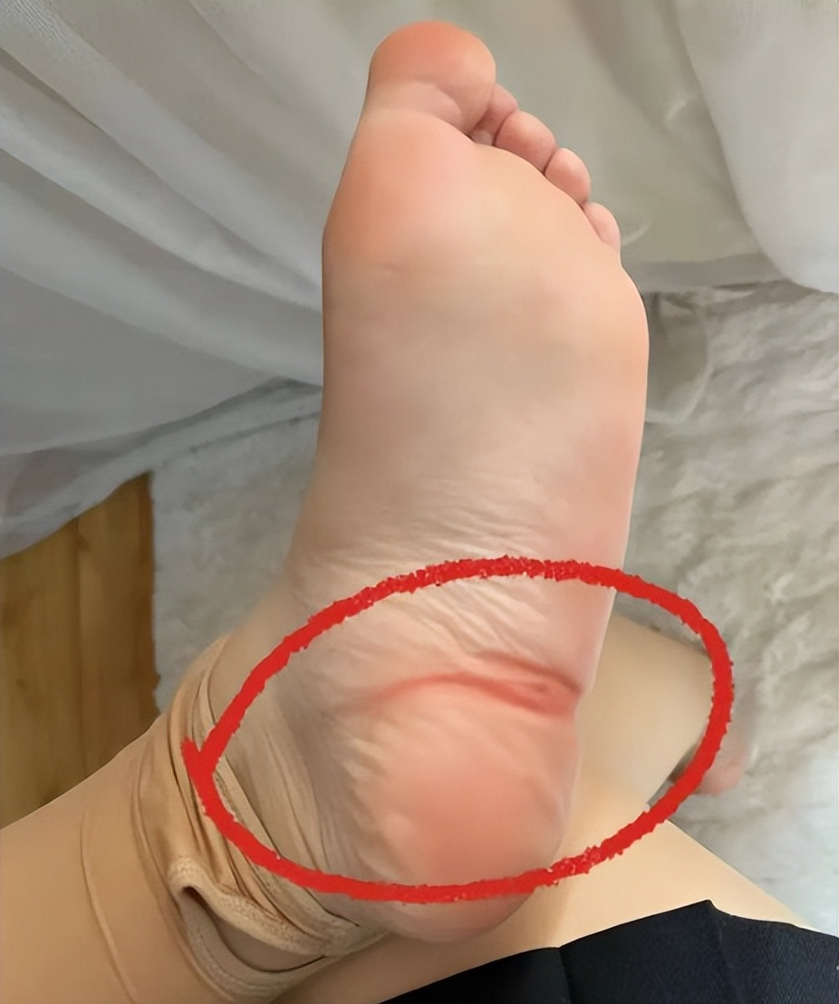 馬上停止穿這種襪子!不知不覺「在傷害下半身」:一堆人秋冬超愛穿