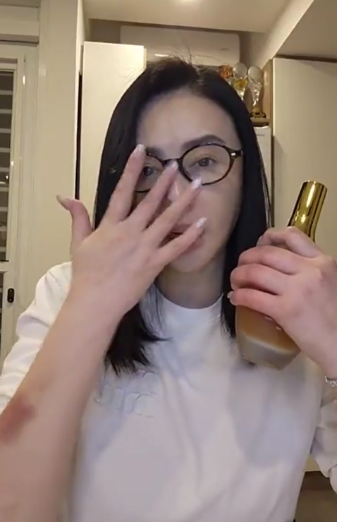 嫁小15歲尪！蕭淑慎結婚8周年「鏡頭前曬全身瘀青」　疑遭家暴她嘆：「不停問自己發生什麼？」