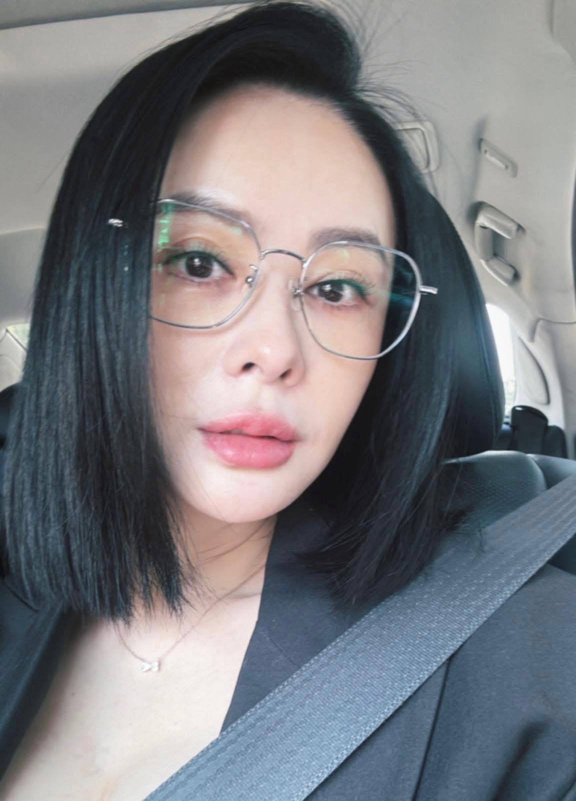 嫁小15歲尪！蕭淑慎結婚8周年「鏡頭前曬全身瘀青」　疑遭家暴她嘆：「不停問自己發生什麼？」