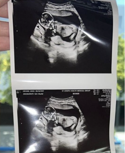 男同代孕惹議!他曝孕母無碼照「嘲諷這部位翹很高」 嗆不需產檢「身分疑是慈濟醫生」