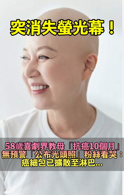 低調抗癌10個月!58歲喜劇界教母「無預警停工」 苦熬12次化療「公開光頭照」認:已轉移至淋巴