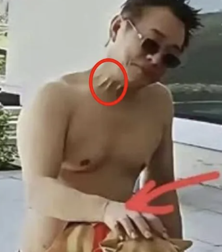 李連杰才遭疑換器官!73歲洪金寶爆「坐輪椅卻神回春」 知情人曝「注射2液體」:中國權貴都在用