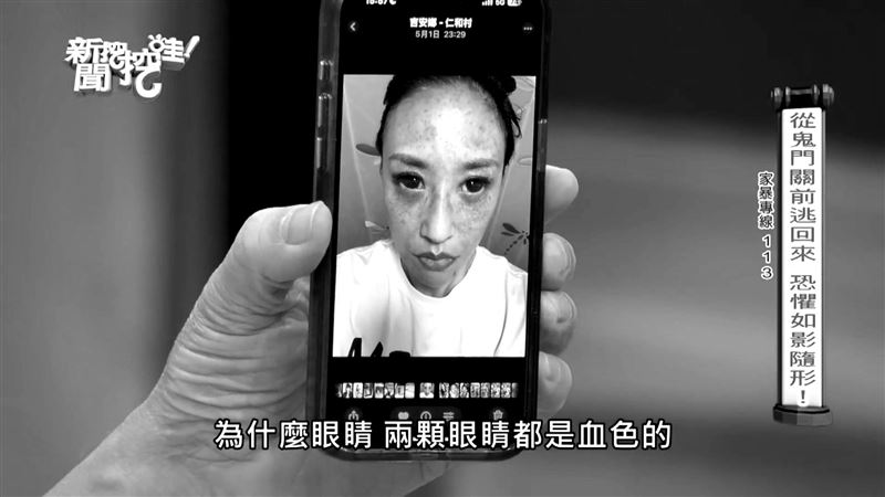 昔讚國手尪1天6次!44歲金鐘女星曝「恐怖家暴照」 髮勒脖「雙眼充血」余祥銓心疼發聲