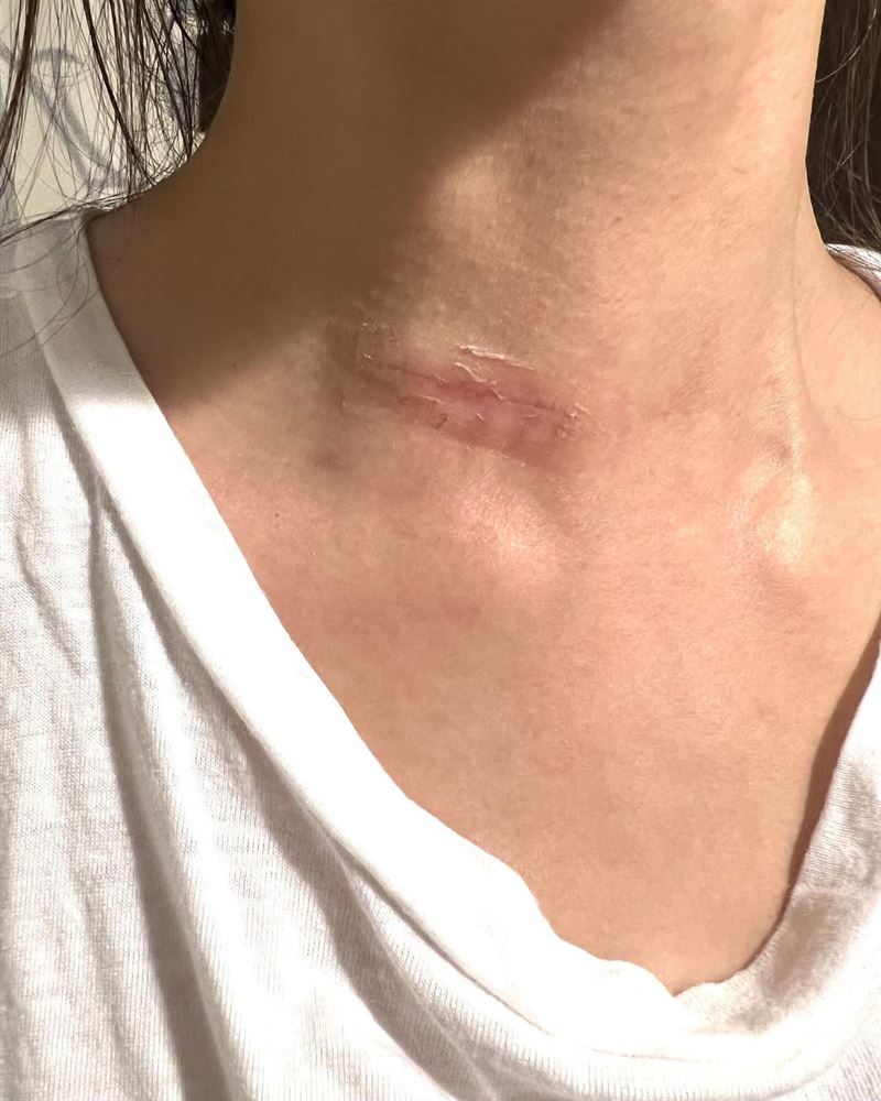 曾悲喊為什麼是我！台灣女星「罹癌開刀續命」　最新病況曝光