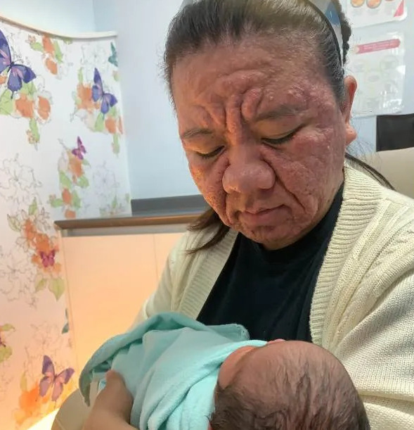 因懷孕容貌大變！28歲準媽媽崩潰「變成60歲阿嬤」　公開「原本清秀模樣」：為什麼是我...