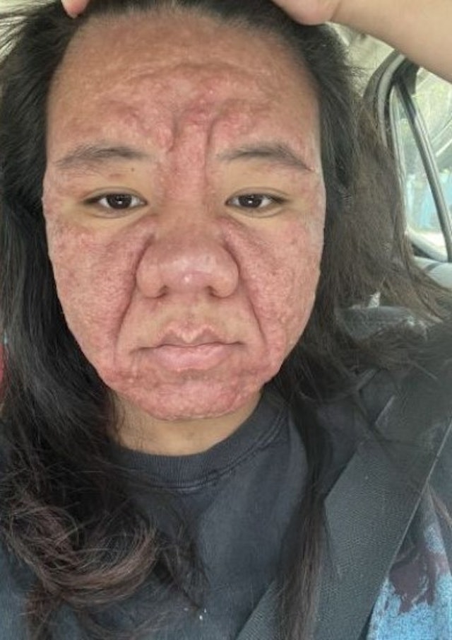 因懷孕容貌大變！28歲準媽媽崩潰「變成60歲阿嬤」　公開「原本清秀模樣」：為什麼是我...