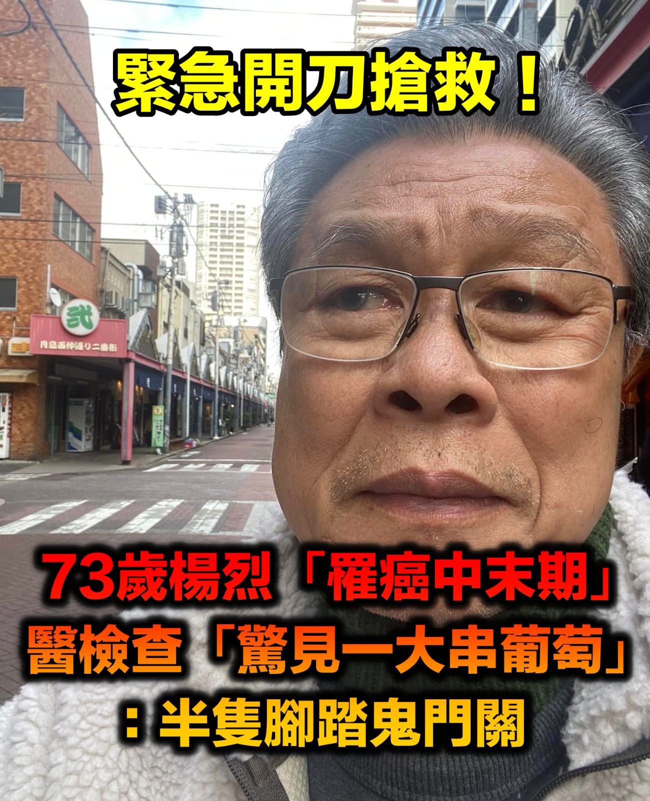 緊急開刀搶救!73歲台灣歌王「罹大腸癌中末期」 醫師驚「身體拿出一串葡萄」:半腳踩鬼門關