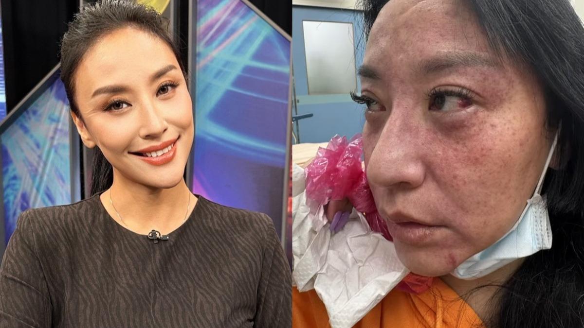 被老公勒脖險死！44歲女星開撕「遭公公用母語開罵」　凌晨收小三「大尺度照片」崩潰　