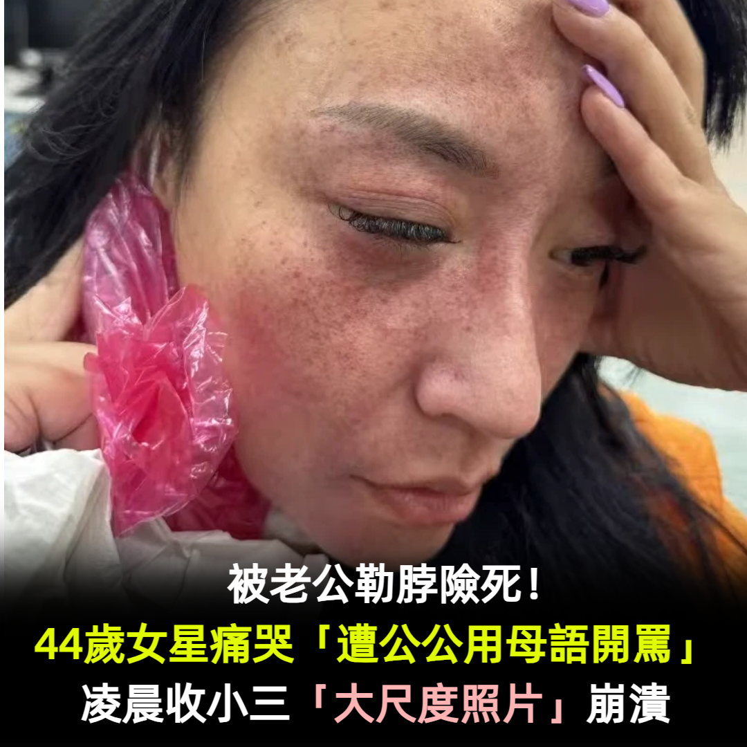 被老公勒脖險死！44歲女星開撕「遭公公用母語開罵」　凌晨收小三「大尺度照片」崩潰　