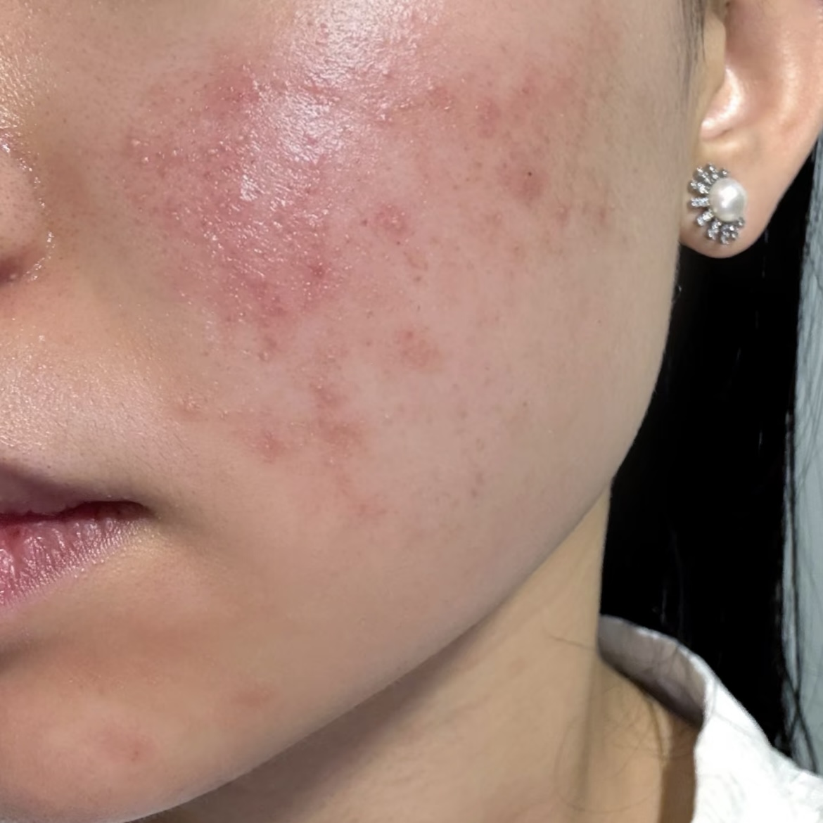 這3種洗面乳「已被列為黑名單」！長期用「直接變爛臉」有的快丟掉