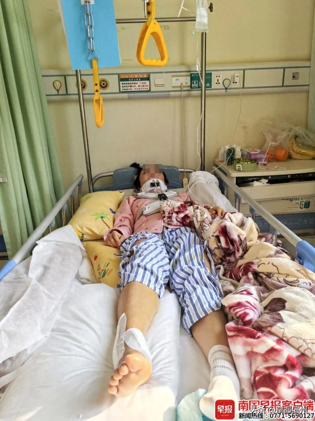 才剛進電梯!婦人「重傷被救出」 搶回小命「治療10個月」原因曝光