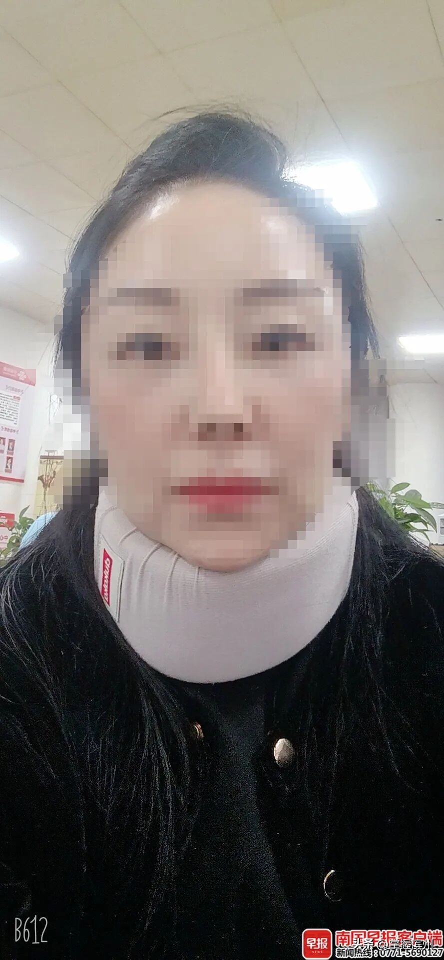 才剛進電梯!婦人「重傷被救出」 搶回小命「治療10個月」原因曝光