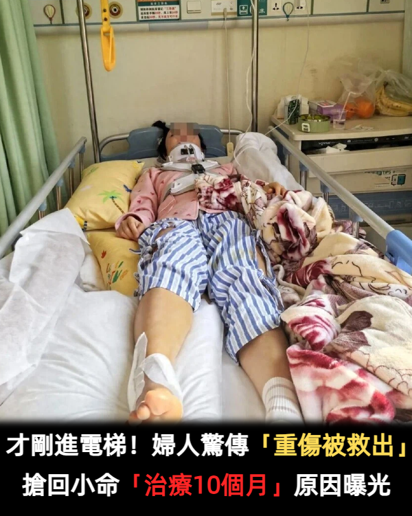 才剛進電梯!婦人「重傷被救出」 搶回小命「治療10個月」原因曝光