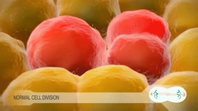 世界衛生組織公告！6種食物「被證實促癌」　很多人每天都在吃「尤其第2樣」老人家超愛