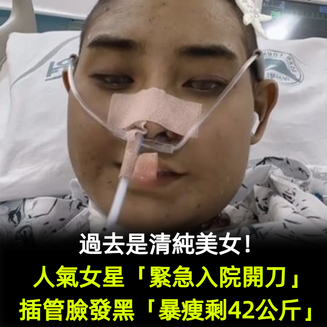 罹急性肝衰竭！人氣女星「緊急入院開刀」插管臉發黑　一度「暴瘦剩42公斤」現況曝光
