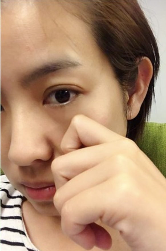 苦喊手術費用太貴!米可白動刀「完成人生大事」 男友貼心陪病「媽媽現身一句話」讓她哭了