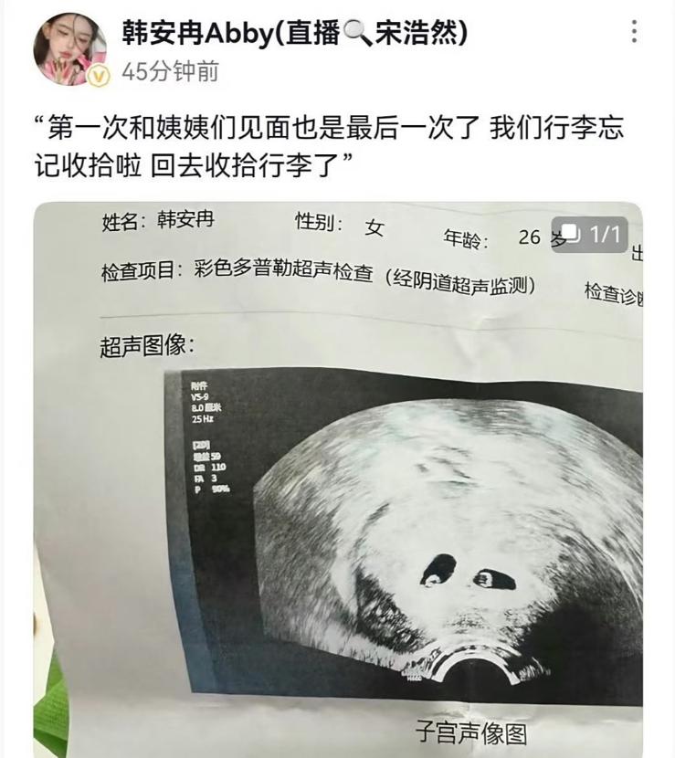 已經四婚三離!知名大咖「出道後整形33次」全國爆紅 如今26歲「現況卻讓人搖頭」:自作自受...