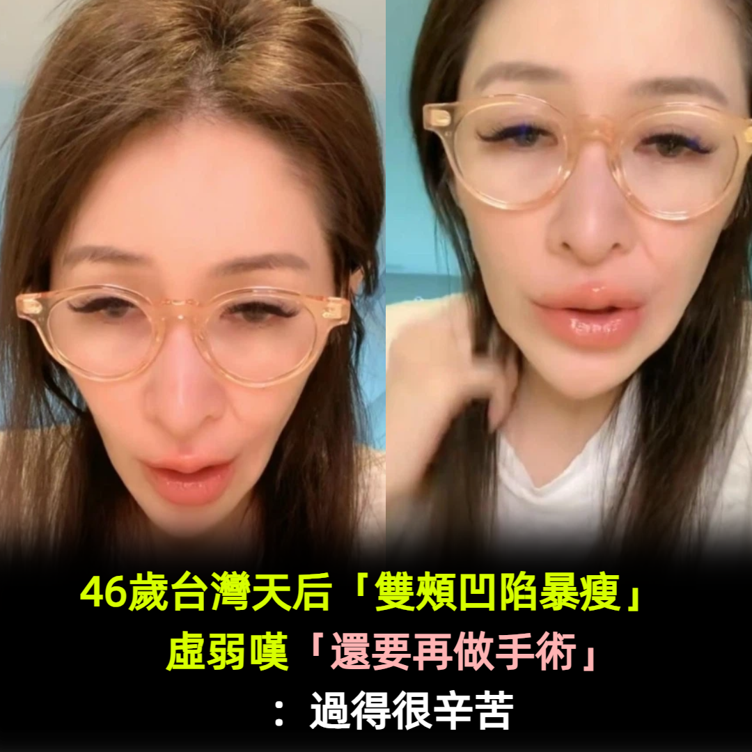 健康亮紅燈！46歲台灣天后「雙頰凹陷暴瘦」粉絲認不出　虛弱嘆「還要再做手術」：過得很辛苦