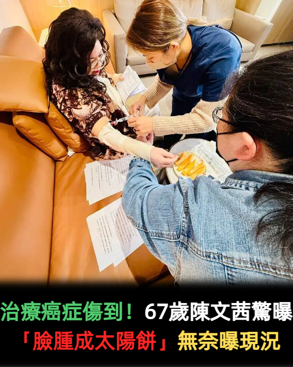 治療癌症傷到！67歲陳文茜驚曝「臉腫成太陽餅」　堅持「扎針也要錄影」無奈曝現況