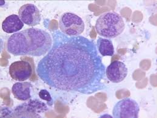 台中11歲女童「大叫後身亡」！檢體驗出「1傳染性病毒」地檢署急發聲：無特效藥