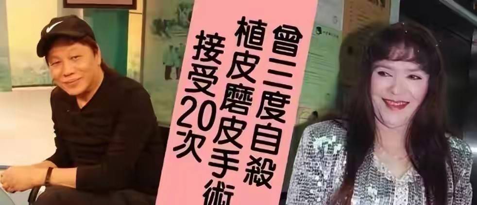 嫁給影壇巨星！她某晚「竟遭潑硫酸毀容」美貌回不去　三度試圖了結「74歲結束戲劇化一生」
