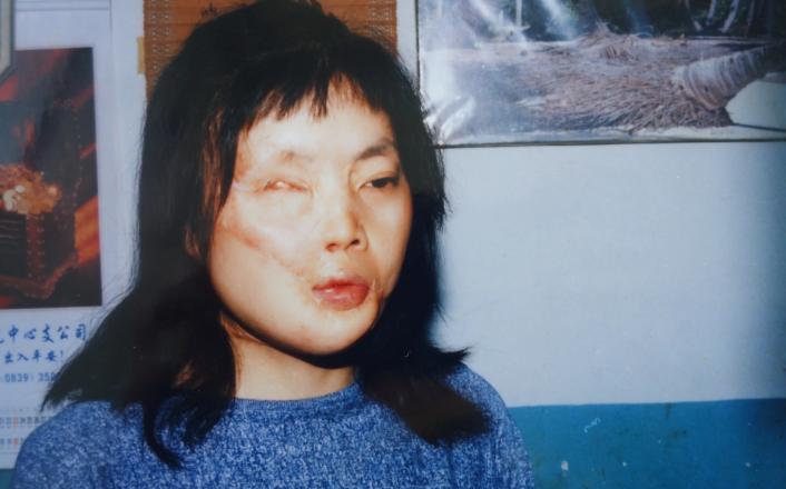 嫁給影壇巨星！她某晚「竟遭潑硫酸毀容」美貌回不去　三度試圖了結「74歲結束戲劇化一生」