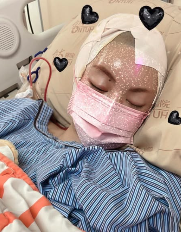 快訊／苦熬28次化療！29歲台灣女模「剃光頭樂觀抗癌4年」　弟弟突發噩耗：「沒有病痛了」