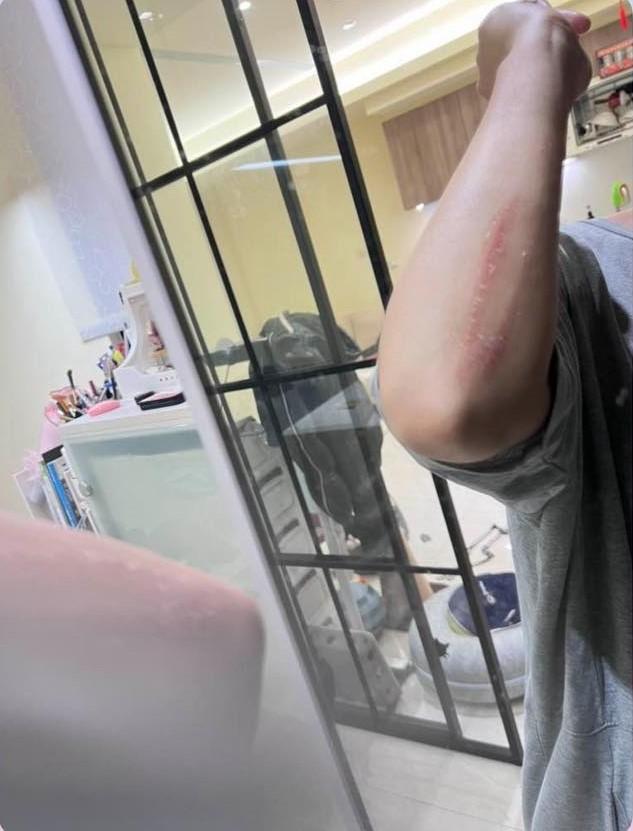 米可白「驚傳車禍」整個人飛出去!