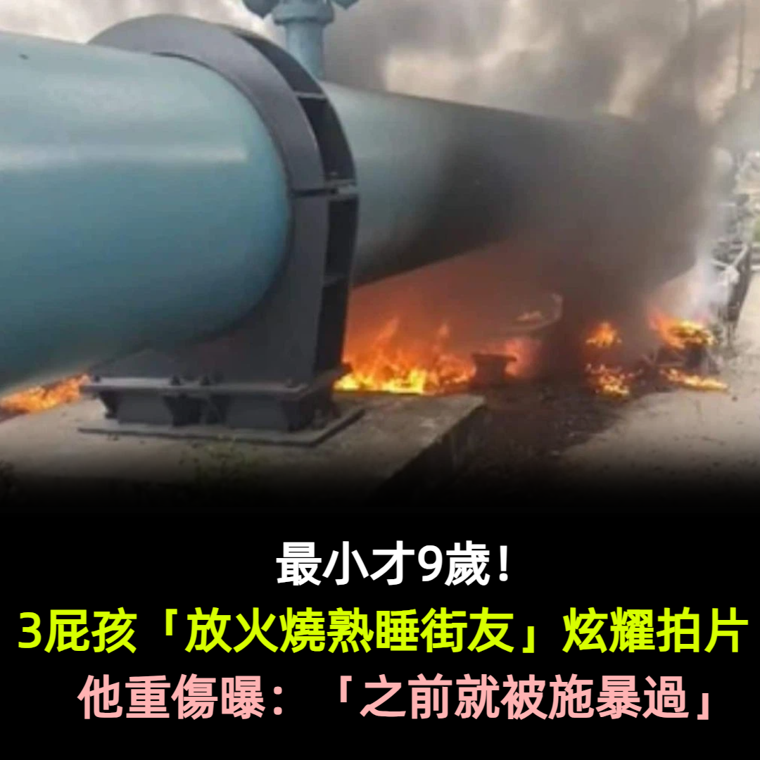 最小才9歲！3屁孩「放火燒熟睡街友」炫耀拍片　他重傷曝：「之前就被施暴過」