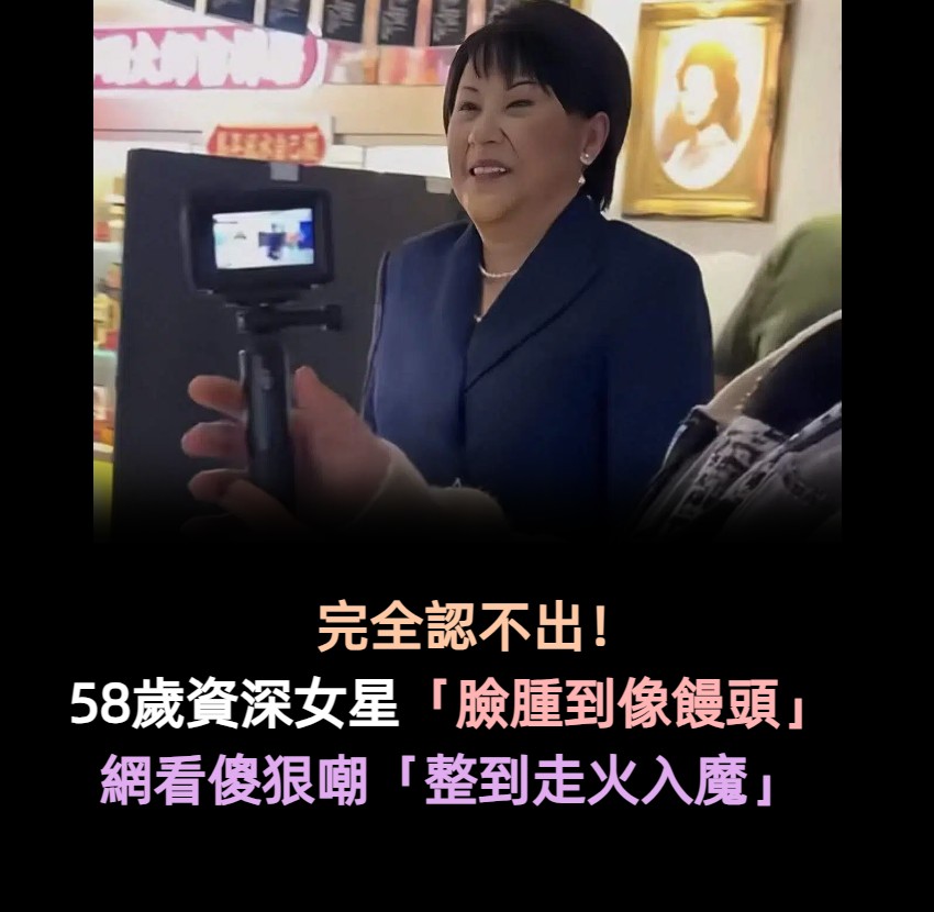 完全認不出!58歲資深女星「臉腫到像饅頭」 網看傻狠嘲「整到走火入魔」