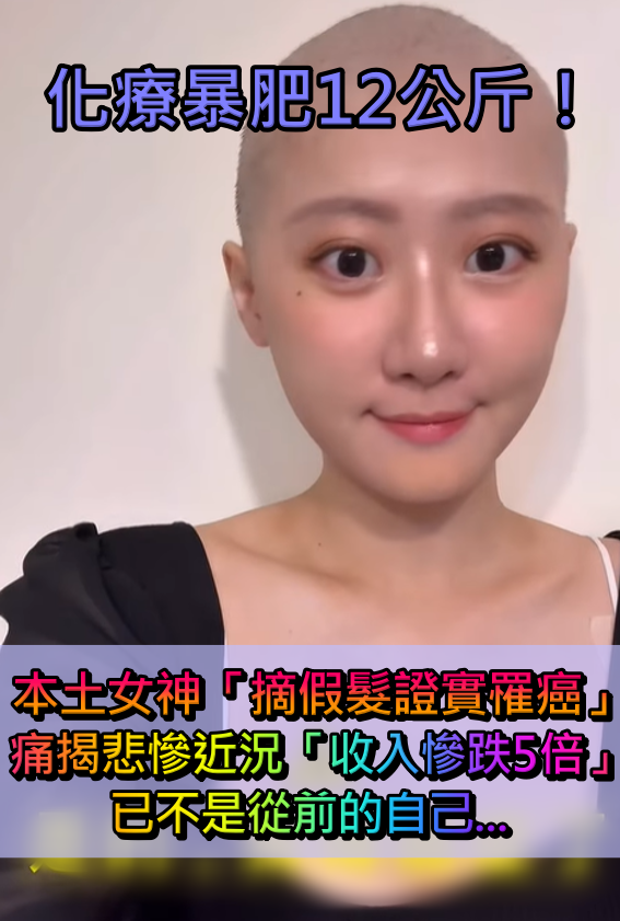 化療暴肥12公斤!本土女神「摘假髮證實罹癌」 痛揭「收入慘跌5倍」:已不是從前的自己