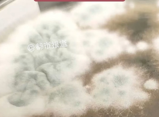 過年前大掃除後！6歲女孩「連續發燒17天」　緊急送醫「腦被啃出20多洞」醫嚇壞：再晚就來不及