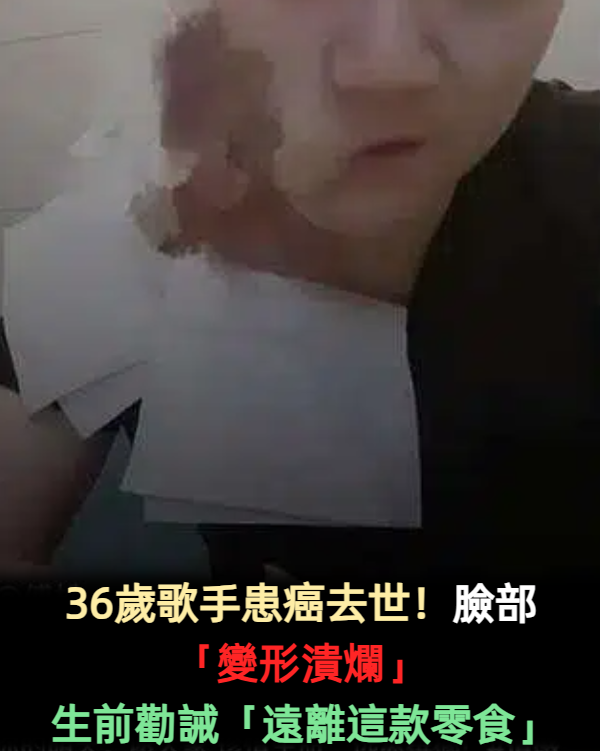 36歲歌手患癌去世！臉部已變形潰爛「病因曝光」　生前勸誡網友遠離「這款零食」：正在毀掉很多人