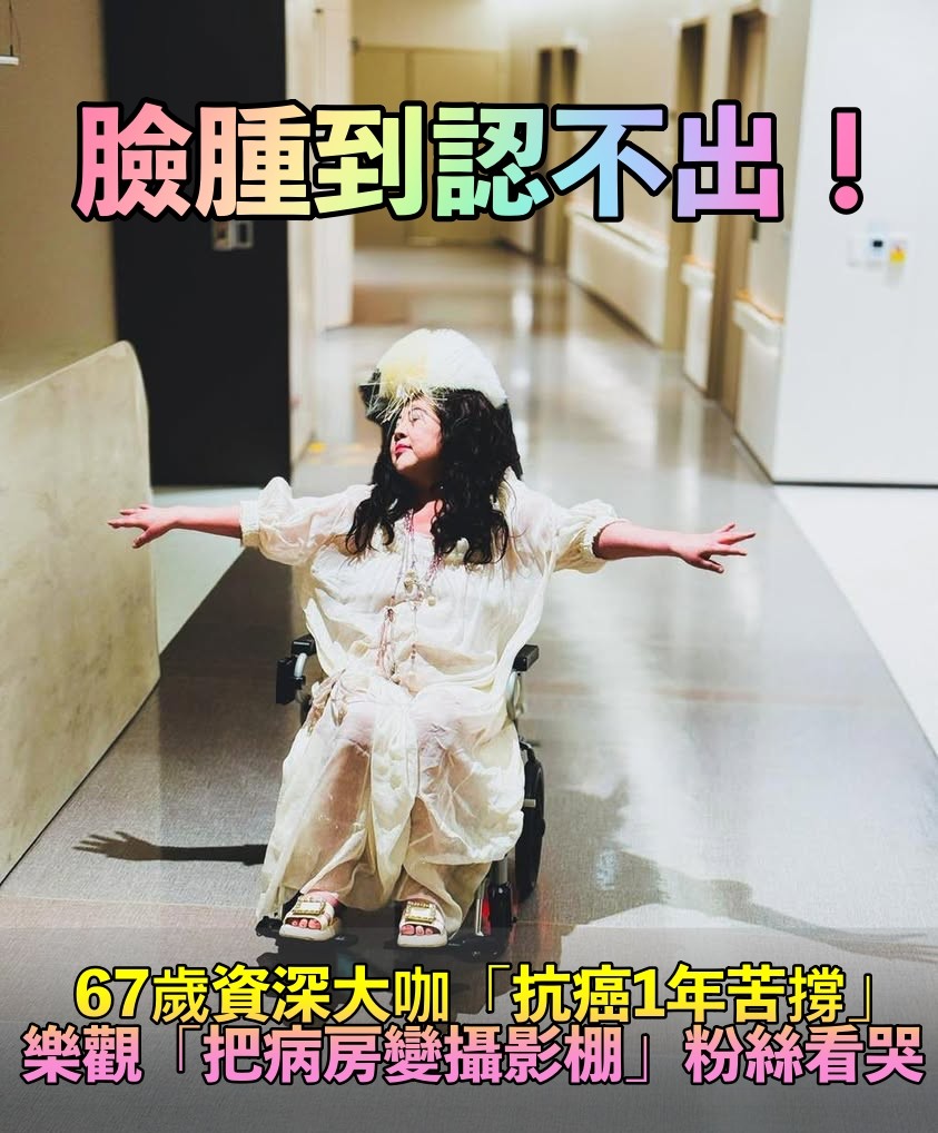 曾被判只剩3個月！67歲資深大咖「不放棄抗癌1年」　樂觀「把病房變攝影棚」：不辜負每一個當下