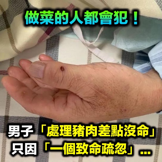 男子處理豬肉差點沒命！只因「一個致命疏忽」　做菜的人都會犯：太常見了