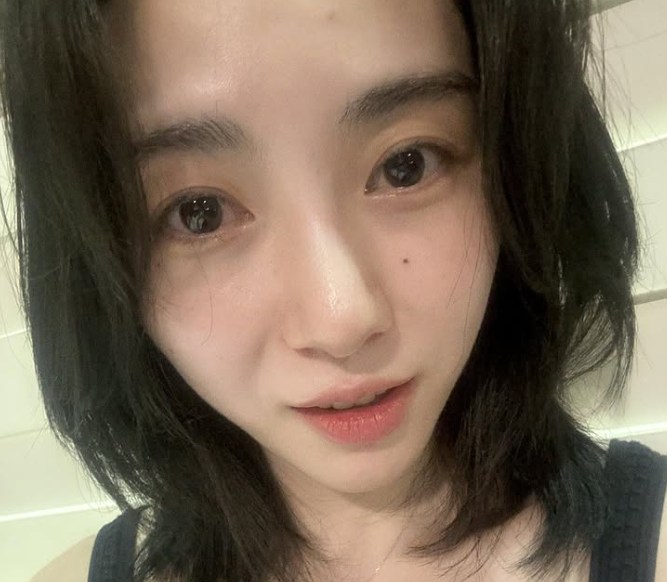 元旦才輕生被救回！知名女星「再遇事故臉部毀容」　崩潰還原過程：「感受撕裂般疼痛...」