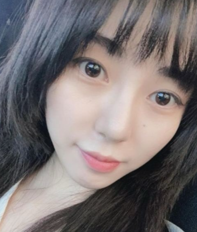 元旦才輕生被救回！知名女星「再遇事故臉部毀容」　崩潰還原過程：「感受撕裂般疼痛...」